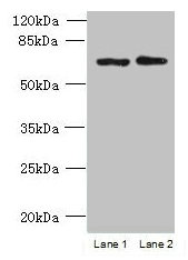 Western blot  | All lanes: TBC1D19 antibody at 9µg/ml  | Lane 1: U251 whole cell lysate  | Lane 2: A375 whole cell lysate  | Secondary  | Goat polyclonal to rabbit IgG at 1/10000 dilution  | Predicted band size: 61, 53 kDa  | Observed band size: 61 kDaRabbit anti-Human TBC1D19 Polyclonal Antibody