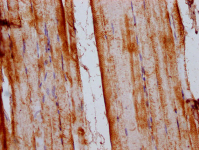 IHC image of SLC15A4 Antibody diluted at 1:200 and staining in paraffin-embedded human skeletal muscle tissue performed on a Leica BondTM system. After dewaxing and hydration, antigen retrieval was mediated by high pressure in a citrate buffer (pH 6.0). Section was blocked with 10% normal goat serum 30min at RT. Then primary antibody (1% BSA) was incubated at 4°C overnight. The primary is detected by a biotinylated secondary antibody and visualized using an HRP conjugated SP system.Rabbit anti-Human SLC15A4 Polyclonal Antibody
