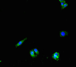 Immunofluorescent analysis of HepG2 cells using PNPLA1 Antibody at dilution of 1:100 and Alexa Fluor 488-congugated AffiniPure Goat Anti-Rabbit IgG(H+L)Rabbit anti-Human PNPLA1 Polyclonal Antibody