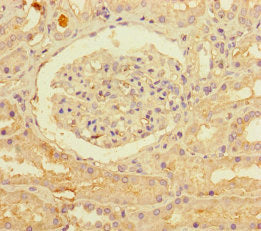 Immunohistochemistry of paraffin-embedded human kidney tissue using PNPLA1 Antibody at dilution of 1:100Rabbit anti-Human PNPLA1 Polyclonal Antibody