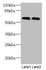 Western Blot | All lanes: PNPLA1 antibody at 12μg/ml | Lane 1: Mouse spleen tissue | Lane 2: Mouse skeletal muscle tissue | Secondary | Goat polyclonal to rabbit IgG at 1/10000 dilution | Predicted band size: 58, 48, 49 kDa | Observed band size: 58 kDaRabbit anti-Human PNPLA1 Polyclonal Antibody