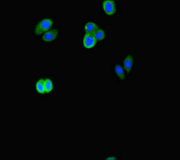 Immunofluorescent analysis of HepG2 cells using ATG16L2 Antibody at dilution of 1:100 and Alexa Fluor 488-congugated AffiniPure Goat Anti-Rabbit IgG(H+L)Rabbit anti-Human ATG16L2 Polyclonal Antibody