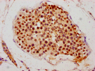 IHC image of the antibody diluted at 1:700 and staining in paraffin-embedded human testis tissue performed on a Leica BondTM system. After dewaxing and hydration, antigen retrieval was mediated by high pressure in a citrate buffer (pH 6.0). Section was blocked with 10% normal goat serum 30min at RT. Then primary antibody (1% BSA) was incubated at 4°C overnight. The primary is detected by a biotinylated secondary antibody and visualized using an HRP conjugated SP system.