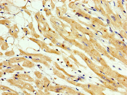 IHC image of CNNM3 Antibody diluted at 1:200 and staining in paraffin-embedded human heart tissue performed on a Leica BondTM system. After dewaxing and hydration, antigen retrieval was mediated by high pressure in a citrate buffer (pH 6.0). Section was blocked with 10% normal goat serum 30min at RT. Then primary antibody (1% BSA) was incubated at 4°C overnight. The primary is detected by a biotinylated secondary antibody and visualized using an HRP conjugated SP system.Rabbit anti-Human CNNM3 Polyclonal Antibody