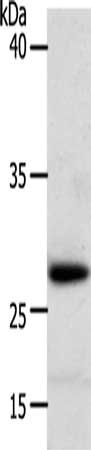 Gel: 10+15%SDS-PAGE, Lysate: 50 μg, Lane: Human liver cancer tissue, Primary antibody: RARRES1 Antibody(RARRES1 Antibody) at dilution 1/300, Secondary antibody: Goat anti rabbit IgG at 1/8000 dilution, Exposure time: 40 secondsRabbit anti-Human RARRES1 Polyclonal Antibody