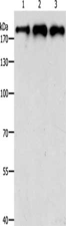 Gel: 8%SDS-PAGE, Lysate: 50 μg, Lane 1-3: K562 cells, 293T cells, hepG2 cells, Primary antibody: SMARCA4 Antibody(SMARCA4 Antibody) at dilution 1/300, Secondary antibody: Goat anti rabbit IgG at 1/8000 dilution, Exposure time: 1 minuteRabbit anti-Human SMARCA4 Polyclonal Antibody