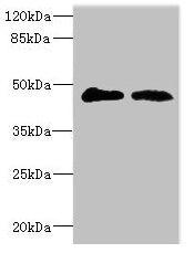 Western blot  | All lanes: GCNT2 antibody at 3.99µg/ml  | Lane 1: 293T whole cell lysate  | Lane 2: Mouse placenta tissue  | Secondary  | Goat polyclonal to rabbit IgG at 1/10000 dilution  | Predicted band size: 46, 47 kDa  | Observed band size: 46 kDaRabbit anti-Human GCNT2 Polyclonal Antibody