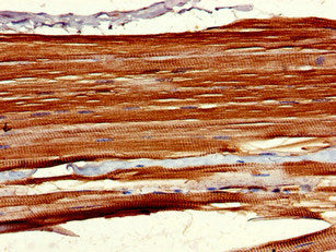 Immunohistochemistry of paraffin-embedded human skeletal muscle tissue using LHFPL5 Antibody at dilution of 1:100