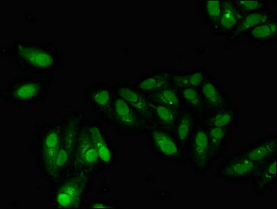 Immunofluorescent analysis of Hela cells using GABPB2 Antibody at dilution of 1:100 and Alexa Fluor 488-congugated AffiniPure Goat Anti-Rabbit IgG(H+L)Rabbit anti-Human GABPB2 Polyclonal Antibody