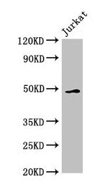 Western Blot  | Positive WB detected in: Jurkat whole cell lysate  | All lanes: GABPB2 antibody at 2.5µg/ml  | Secondary  | Goat polyclonal to rabbit IgG at 1/50000 dilution  | Predicted band size: 49 kDa  | Observed band size: 49 kDaRabbit anti-Human GABPB2 Polyclonal Antibody