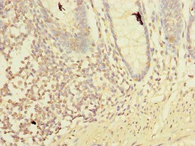 Immunohistochemistry of paraffin-embedded human colon tissue using LMO3 Antibody at dilution of 1:100