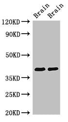 Western Blot | Positive WB detected in: Rat brain tissue, Mouse brain tissue | All lanes: STOML3 antibody at 3.4μg/ml | Secondary | Goat polyclonal to rabbit IgG at 1/50000 dilution | Predicted band size: 33, 32 kDa | Observed band size: 40 kDaRabbit anti-Human STOML3 Polyclonal Antibody