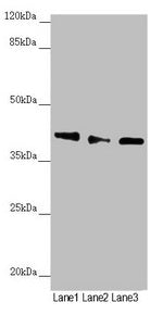 Western blot  | All lanes: DYNC2LI1 antibody at 1.17µg/ml  | Lane 1: 293T whole cell lysate  | Lane 2: A549 whole cell lysate  | Lane 3: Mouse gonadal tissue  | Secondary  | Goat polyclonal to rabbit IgG at 1/10000 dilution  | Predicted band size: 40, 38, 23, 16 kDa  | Observed band size: 40 kDaRabbit anti-Human DYNC2LI1 Polyclonal Antibody
