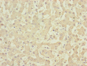 Immunohistochemistry of paraffin-embedded human liver tissue using DYNC2LI1 Antibody at dilution of 1:100Rabbit anti-Human DYNC2LI1 Polyclonal Antibody