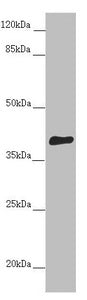 Western blot | All lanes: DYNC2LI1 antibody at 1.06 μg/ml + Mouse gonadal tissue | Secondary | Goat polyclonal to rabbit IgG at 1/10000 dilution | Predicted band size: 40, 38, 23, 16 kDa | Observed band size: 40 kDaRabbit anti-Human DYNC2LI1 Polyclonal Antibody