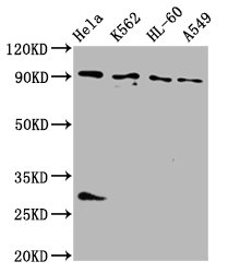 Western Blot  | Positive WB detected in: Hela whole cell lysate, K562 whole cell lysate, HL60 whole cell lysate, A549 whole cell lysate  | All lanes: BICD2 antibody at 4µg/ml  | Secondary  | Goat polyclonal to rabbit IgG at 1/50000 dilution  | Predicted band size: 94, 97 kDa  | Observed band size: 94 kDa