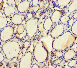 Immunohistochemistry of paraffin-embedded human thyroid tissue using UBE2Q2 Antibody at dilution of 1:100Rabbit anti-Human UBE2Q2 Polyclonal Antibody