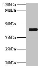 Western blot  | All lanes: UBE2Q2 antibody at 2µg/ml + A431 whole cell lysate  | Secondary  | Goat polyclonal to rabbit IgG at 1/10000 dilution  | Predicted band size: 43, 37, 41, 39 kDa  | Observed band size: 43 kDaRabbit anti-Human UBE2Q2 Polyclonal Antibody