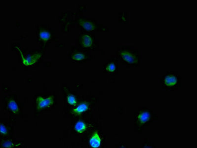 Immunofluorescent analysis of U251 cells using SSMEM1 Antibody at dilution of 1:100 and Alexa Fluor 488-congugated AffiniPure Goat Anti-Rabbit IgG(H+L)Rabbit anti-Human SSMEM1 Polyclonal Antibody
