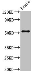 Western Blot  | Positive WB detected in: Rat brain tissue  | All lanes: ASZ1 antibody at 2.7µg/ml  | Secondary  | Goat polyclonal to rabbit IgG at 1/50000 dilution  | Predicted band size: 54, 53 kDa  | Observed band size: 54 kDaRabbit anti-Human ASZ1 Polyclonal Antibody