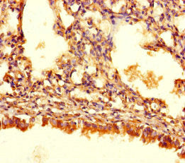 Immunohistochemistry of paraffin-embedded human lung tissue using ASB10 Antibody at dilution of 1:100Rabbit anti-Human ASB10 Polyclonal Antibody