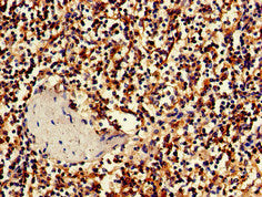 Immunohistochemistry of paraffin-embedded human spleen tissue using the antibody at dilution of 1:100