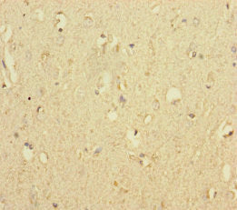 Immunohistochemistry of paraffin-embedded human brain tissue using MTO1 Antibody at dilution of 1:100Rabbit anti-Human MTO1 Polyclonal Antibody