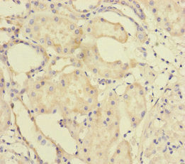 Immunohistochemistry of paraffin-embedded human kidney tissue using MTO1 Antibody at dilution of 1:100Rabbit anti-Human MTO1 Polyclonal Antibody