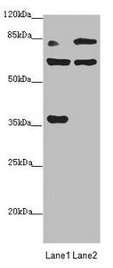 Western blot  | All lanes: MTO1 antibody at 2.25µg/ml  | Lane 1: Rat heart tissue  | Lane 2: Jurkat whole cell lysate  | Secondary  | Goat polyclonal to rabbit IgG at 1/10000 dilution  | Predicted band size: 80, 67, 35, 78, 73, 82 kDa  | Observed band size: 80, 67, 35 kDaRabbit anti-Human MTO1 Polyclonal Antibody