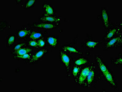 Immunofluorescent analysis of Hela cells using GBF1 Antibody at dilution of 1:100 and Alexa Fluor 488-congugated AffiniPure Goat Anti-Rabbit IgG(H+L)Rabbit anti-Human GBF1 Polyclonal Antibody