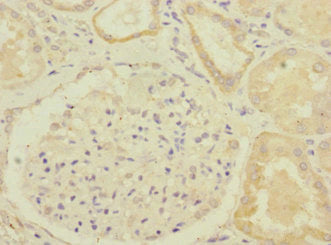 Immunohistochemistry of paraffin-embedded human kidney tissue using the antibody at dilution of 1:100Rabbit anti-Human GBF1 Polyclonal Antibody