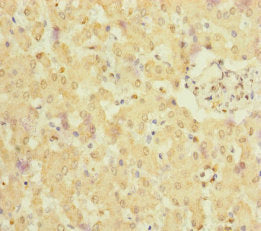 Immunohistochemistry of paraffin-embedded human liver tissue using NELL1 Antibody at dilution of 1:100Rabbit anti-Human NELL1 Polyclonal Antibody