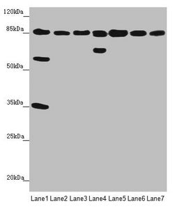 Western blot | All lanes: NELL1 antibody at 3.47 μg/ml | Lane 1: Mouse liver tissue | Lane 2: Mouse kidney tissue | Lane 3: Mouse spleen tissue | Lane 4: Human placenta tissue | Lane 5: Hela whole cell lysate | Lane 6: Jurkat whole cell lysate | Lane 7: MCF-7 whole cell lysate | Secondary | Goat polyclonal to rabbit IgG at 1/10000 dilution | Predicted band size: 90, 85 kDa | Observed band size: 90, 65, 58, 35 kDaRabbit anti-Human NELL1 Polyclonal Antibody