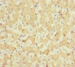 Immunohistochemistry of paraffin-embedded human liver tissue using NELL1 Antibody at dilution of 1:100Rabbit anti-Human NELL1 Polyclonal Antibody