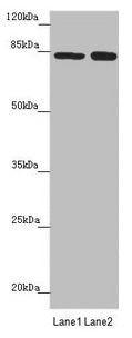 Western blot  | All lanes: NELL1 antibody at 4.52µg/ml  | Lane 1: Hela whole cell lysate  | Lane 2: Jurkat whole cell lysate  | Secondary  | Goat polyclonal to rabbit IgG at 1/10000 dilution  | Predicted band size: 90, 85 kDa  | Observed band size: 85 kDaRabbit anti-Human NELL1 Polyclonal Antibody