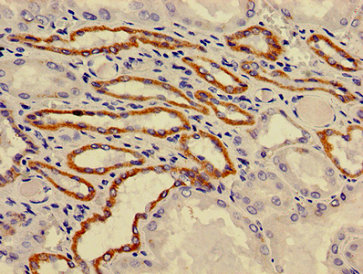 Immunohistochemistry of paraffin-embedded human kidney tissue using ATP6V0A1 Antibody at dilution of 1:100