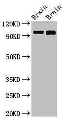 Western Blot | Positive WB detected in: Rat brain tissue, Mouse brain tissue | All lanes: ATP6V0A1 antibody at 3μg/ml | Secondary | Goat polyclonal to rabbit IgG at 1/50000 dilution | Predicted band size: 97, 96 kDa | Observed band size: 97 kDa