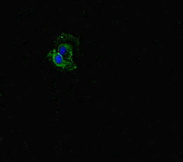 Immunofluorescent analysis of Hela cells using FBXW5 Antibody at dilution of 1:100 and Alexa Fluor 488-congugated AffiniPure Goat Anti-Rabbit IgG(H+L)Rabbit anti-Human FBXW5 Polyclonal Antibody