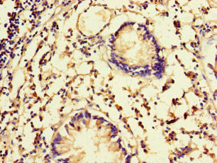 Immunohistochemistry of paraffin-embedded human appendix tissue using FBXW5 Antibody at dilution of 1:100Rabbit anti-Human FBXW5 Polyclonal Antibody
