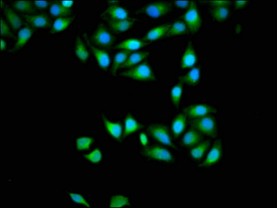 Immunofluorescence staining of Hela cells with APOBEC3D Antibody at 1:133, counter-stained with DAPI. The cells were fixed in 4% formaldehyde, permeabilized using 0.2% Triton X-100 and blocked in 10% normal Goat Serum. The cells were then incubated with the antibody overnight at 4°C. The secondary antibody was Alexa Fluor 488-congugated AffiniPure Goat Anti-Rabbit IgG(H+L).Rabbit anti-Human APOBEC3D Polyclonal Antibody