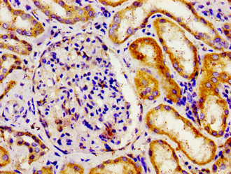Immunohistochemistry of paraffin-embedded human kidney tissue using APOBEC3D Antibody at dilution of 1:100Rabbit anti-Human APOBEC3D Polyclonal Antibody