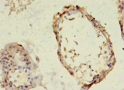 Immunohistochemistry of paraffin-embedded human testis tissue using TBC1D20 Antibody at dilution of 1:100Rabbit anti-Human TBC1D20 Polyclonal Antibody