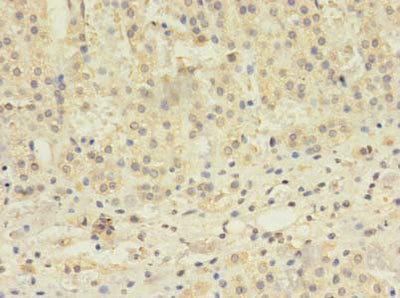 Immunohistochemistry of paraffin-embedded human adrenal gland tissue using TBC1D20 Antibody at dilution of 1:100Rabbit anti-Human TBC1D20 Polyclonal Antibody