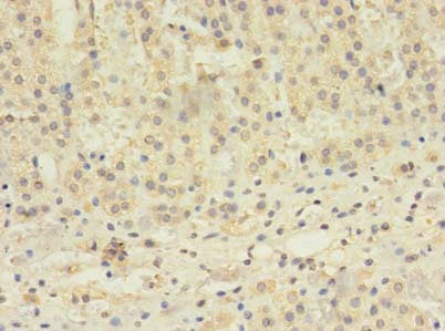 Immunohistochemistry of paraffin-embedded human adrenal gland tissue using TBC1D20 Antibody at dilution of 1:100Rabbit anti-Human TBC1D20 Polyclonal Antibody
