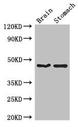 Western Blot | Positive WB detected in: Mouse brain tissue, Mouse stomach tissue | All lanes: TBC1D20 antibody at 4μg/ml | Secondary | Goat polyclonal to rabbit IgG at 1/50000 dilution | Predicted band size: 46, 20, 49 kDa | Observed band size: 46 kDaRabbit anti-Human TBC1D20 Polyclonal Antibody