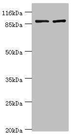 Western blot  | All lanes: GCC1 antibody at 2µg/ml  | Lane 1: Hela whole cell lysate  | Lane 2: 293T whole cell lysate  | Secondary  | Goat polyclonal to rabbit IgG at 1/10000 dilution  | Predicted band size: 88 kDa  | Observed band size: 88 kDaRabbit anti-Human GCC1 Polyclonal Antibody