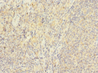 Immunohistochemistry of paraffin-embedded human tonsil tissue using HVCN1 Antibody at dilution of 1:100Rabbit anti-Human HVCN1 Polyclonal Antibody