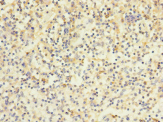 Immunohistochemistry of paraffin-embedded human spleen tissue using HVCN1 Antibody at dilution of 1:100Rabbit anti-Human HVCN1 Polyclonal Antibody