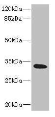 Western blot  | All lanes: HVCN1 antibody at 1.17µg/ml + Raji whole cell lysate  | Secondary  | Goat polyclonal to rabbit IgG at 1/10000 dilution  | Predicted band size: 32, 28, 30 kDa  | Observed band size: 32 kDaRabbit anti-Human HVCN1 Polyclonal Antibody