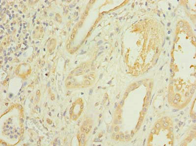 Immunohistochemistry of paraffin-embedded human kidney tissue using CMBL Antibody at dilution of 1:100Rabbit anti-Human CMBL Polyclonal Antibody